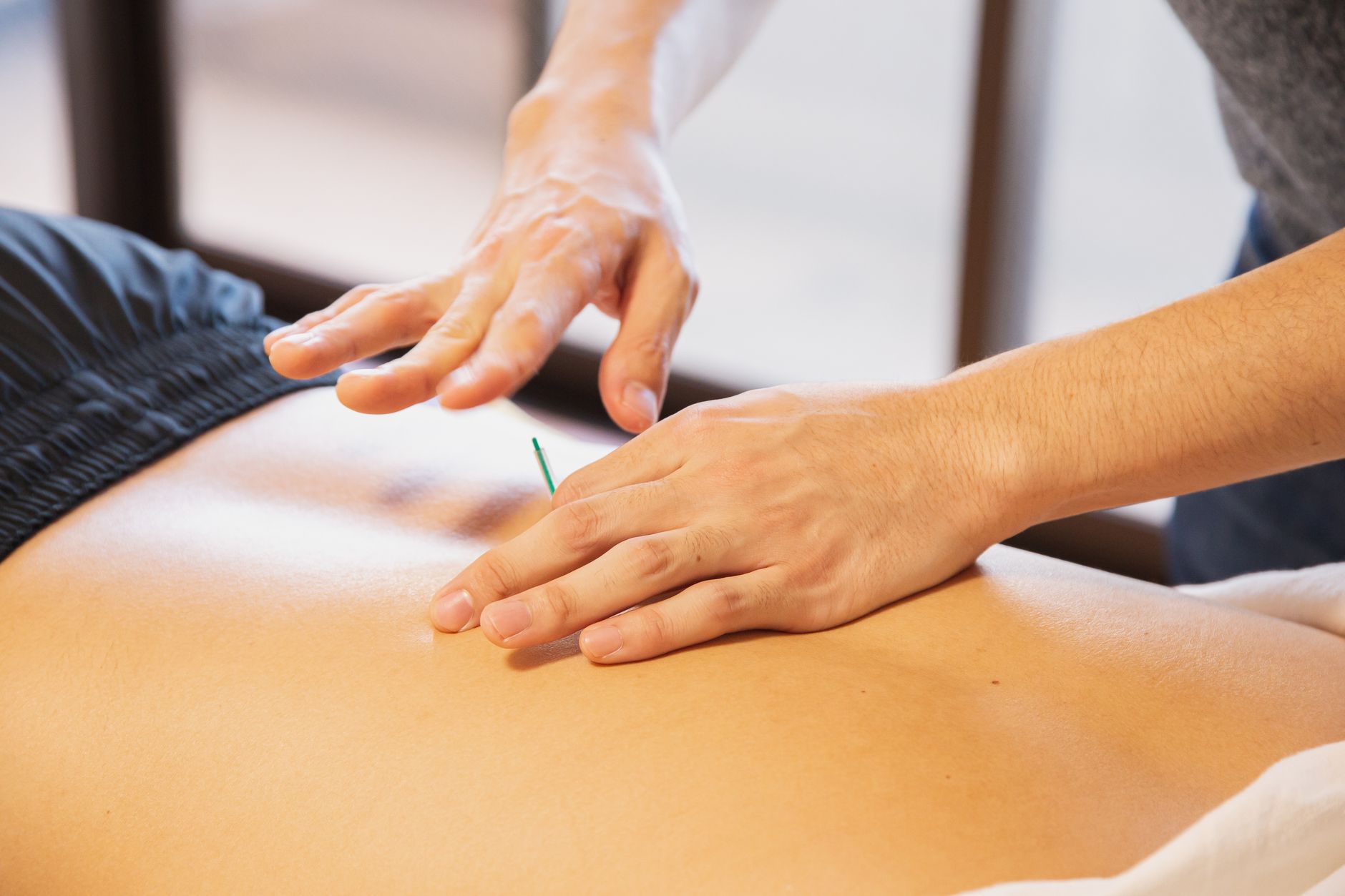 Acupuncture points – therapist placing fine needles on a patient's back.
